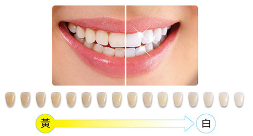 麦芽口腔牙齿比色